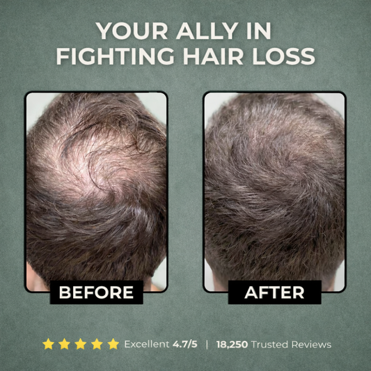 Peak Hair - Peptide Hair Regrowth System